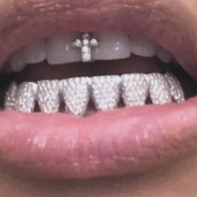 Kim Kardashian Diamond Grillz