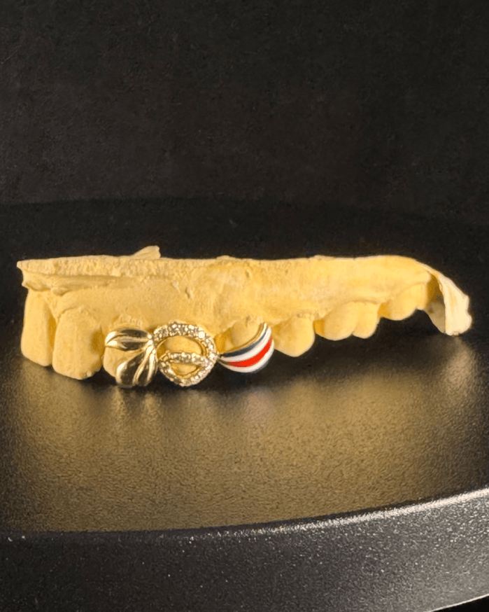 A diamond grillz designed by Jessenia Landrum
